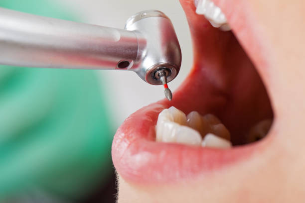 Best Emergency Denture Repair in Henryetta, OK